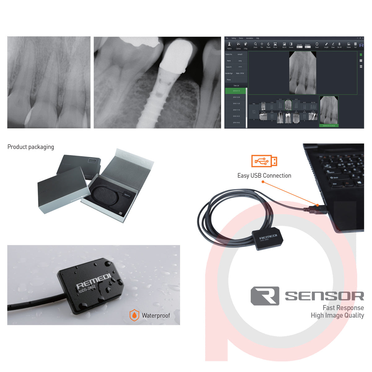 X-ray Sensor