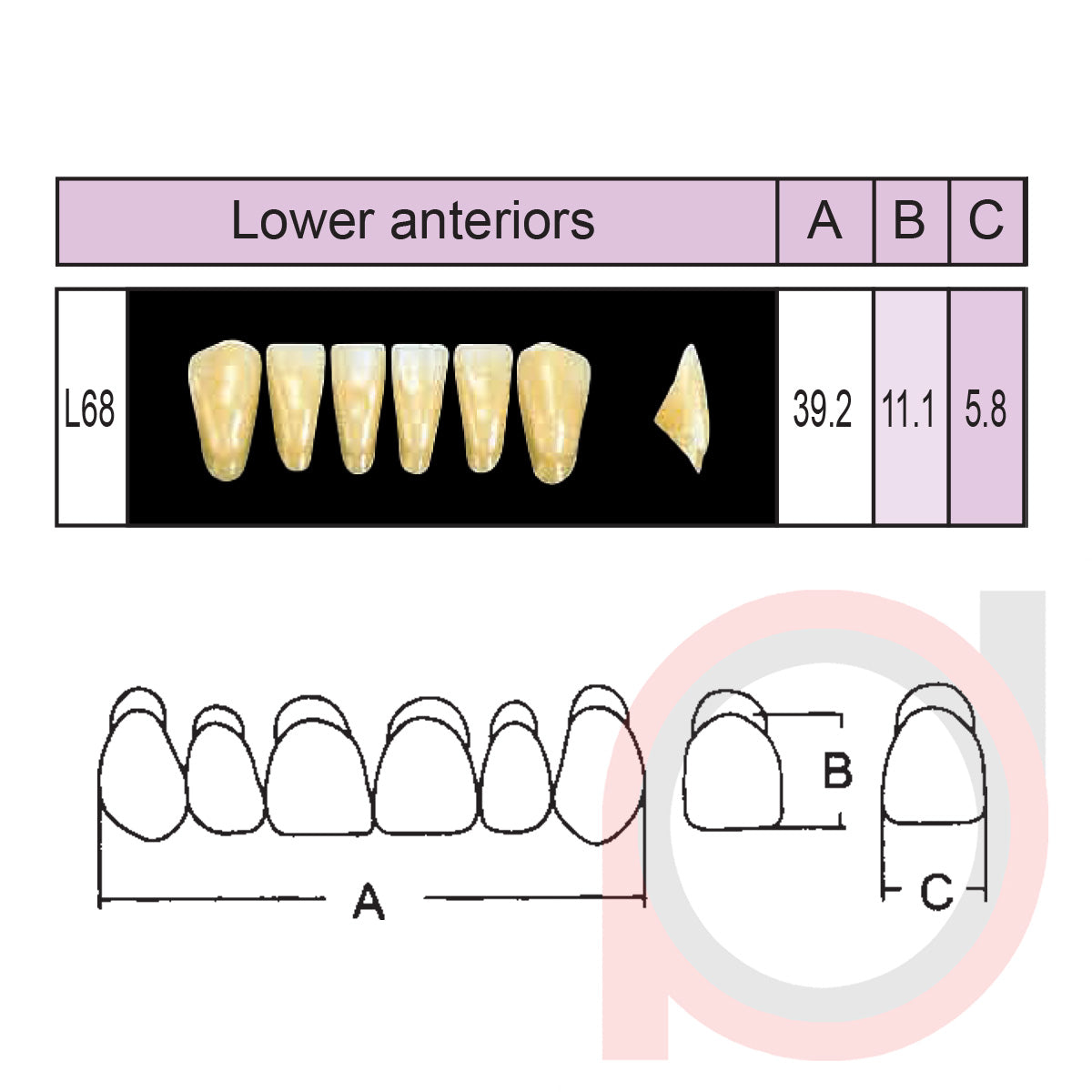 SND Two Layer Lower Anterior (1x6)