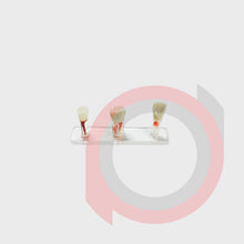 Load image into Gallery viewer, Endo Tooth Model
