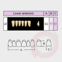 Load image into Gallery viewer, SND Two Layer Lower Anterior (1x6)

