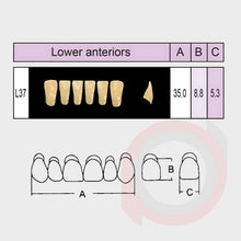 Load image into Gallery viewer, SND Two Layer Lower Anterior (1x6)
