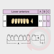 Load image into Gallery viewer, SND Two Layer Lower Anterior (1x6)
