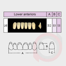 Load image into Gallery viewer, SND Two Layer Lower Anterior (1x6)
