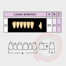 Load image into Gallery viewer, SND Two Layer Lower Anterior (1x6)
