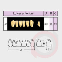 Load image into Gallery viewer, SND Two Layer Lower Anterior (1x6)
