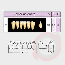 Load image into Gallery viewer, SND Two Layer Lower Anterior (1x6)
