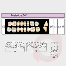 Load image into Gallery viewer, SND Two Layer Posterior (1x8)
