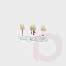 Load image into Gallery viewer, Endo Tooth Model
