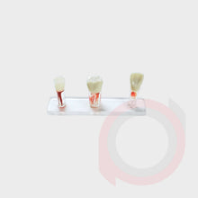 Load image into Gallery viewer, Endo Tooth Model
