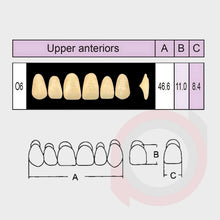 Load image into Gallery viewer, SND Two Layer Upper Anterior (1x6)
