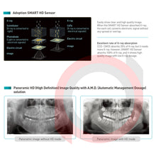 Load image into Gallery viewer, Point 200HD
