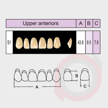 Load image into Gallery viewer, SND Two Layer Upper Anterior (1x6)
