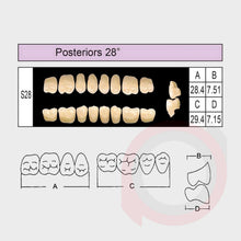 Load image into Gallery viewer, SND Two Layer Posterior (1x8)
