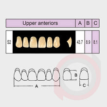 Load image into Gallery viewer, SND Two Layer Upper Anterior (1x6)
