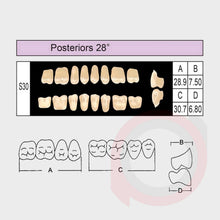Load image into Gallery viewer, SND Two Layer Posterior (1x8)
