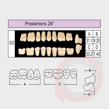 Load image into Gallery viewer, SND Two Layer Posterior (1x8)
