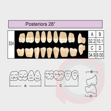 Load image into Gallery viewer, SND Two Layer Posterior (1x8)
