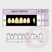 Load image into Gallery viewer, SND Two Layer Upper Anterior (1x6)
