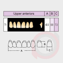 Load image into Gallery viewer, SND Two Layer Upper Anterior (1x6)
