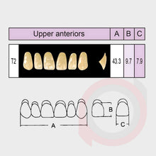 Load image into Gallery viewer, SND Two Layer Upper Anterior (1x6)
