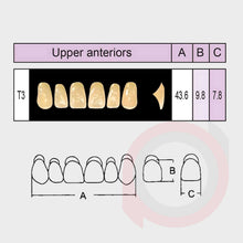 Load image into Gallery viewer, SND Two Layer Upper Anterior (1x6)
