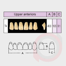 Load image into Gallery viewer, SND Two Layer Upper Anterior (1x6)
