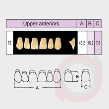 Load image into Gallery viewer, SND Two Layer Upper Anterior (1x6)
