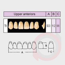 Load image into Gallery viewer, SND Two Layer Upper Anterior (1x6)
