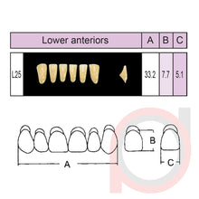 Load image into Gallery viewer, SND Two Layer Lower Anterior (1x6)
