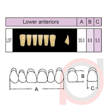 Load image into Gallery viewer, SND Two Layer Lower Anterior (1x6)
