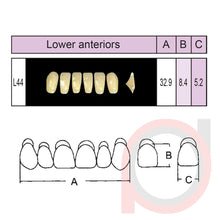Load image into Gallery viewer, SND Two Layer Lower Anterior (1x6)

