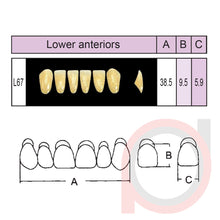 Load image into Gallery viewer, SND Two Layer Lower Anterior (1x6)
