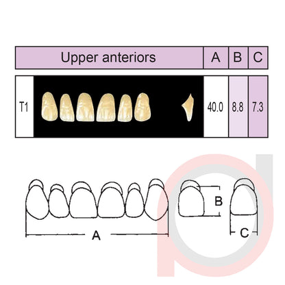 SND Two Layer Upper Anterior (1x6)