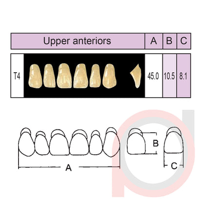 SND Two Layer Upper Anterior (1x6)