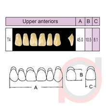 Load image into Gallery viewer, SND Two Layer Upper Anterior (1x6)
