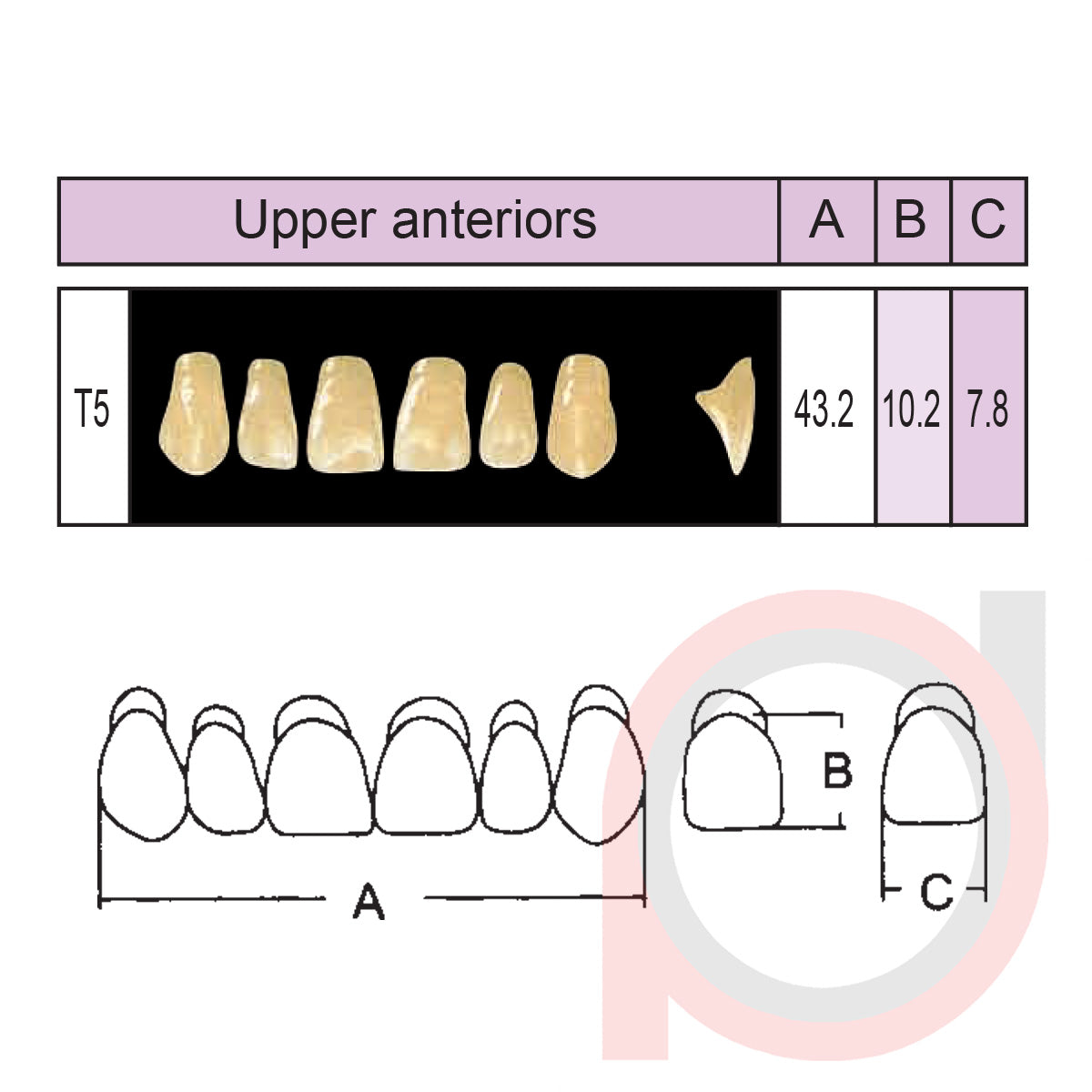 SND Two Layer Upper Anterior (1x6)