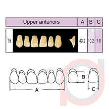 Load image into Gallery viewer, SND Two Layer Upper Anterior (1x6)
