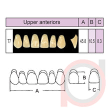 Load image into Gallery viewer, SND Two Layer Upper Anterior (1x6)
