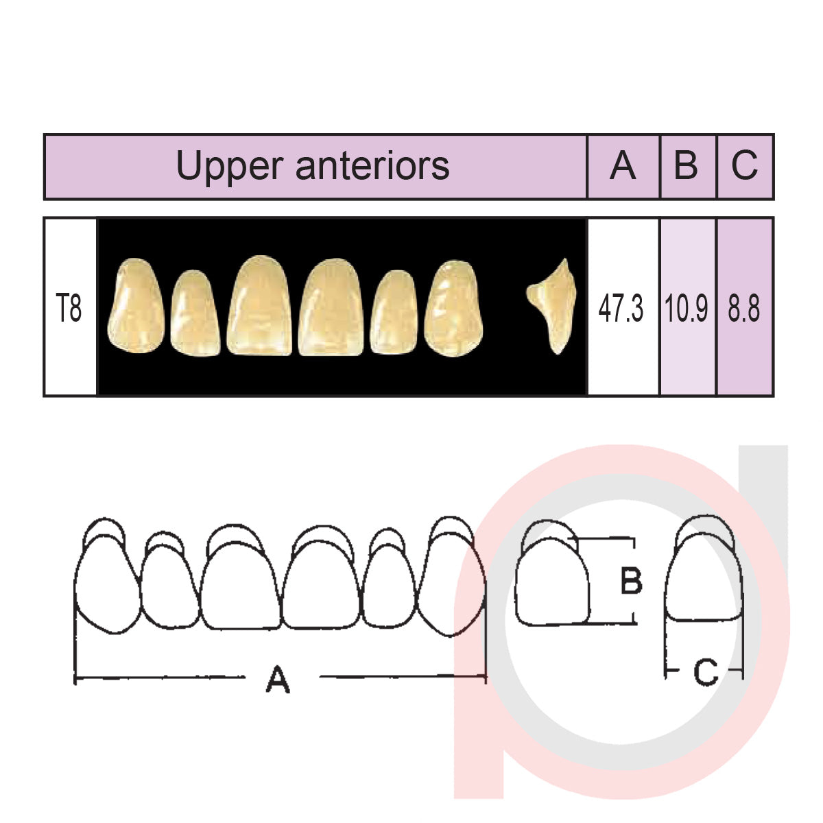 SND Two Layer Upper Anterior (1x6)