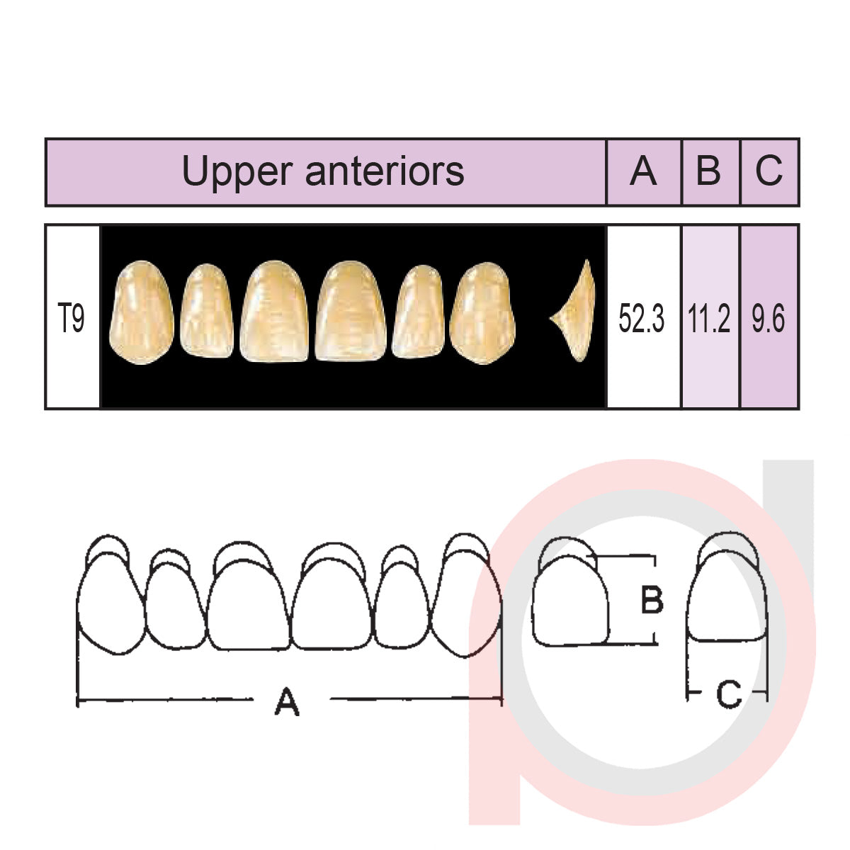SND Two Layer Upper Anterior (1x6)